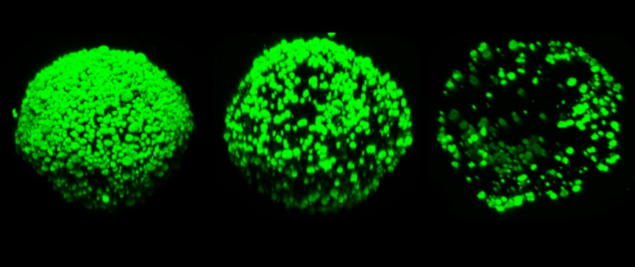 This image has an empty alt attribute; its file name is sura-hap-microgels.jpg